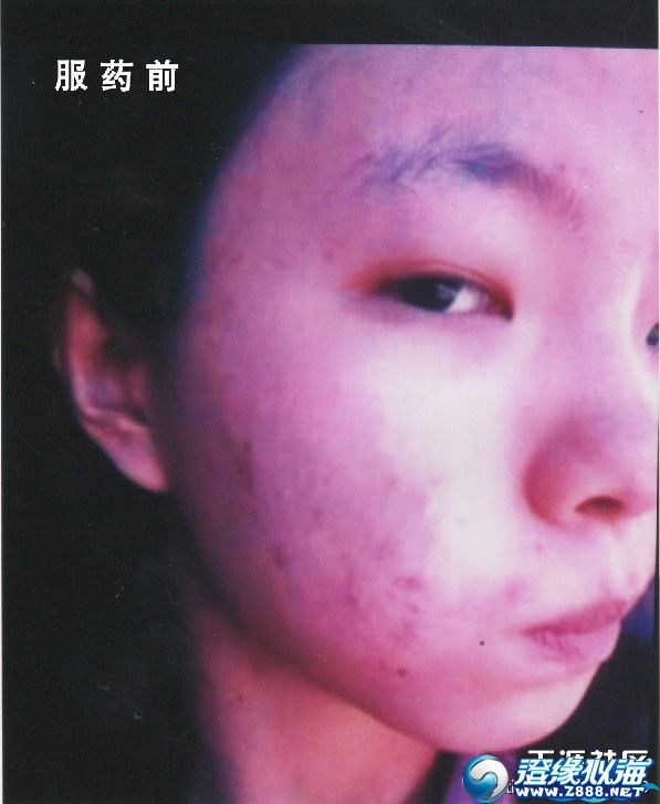 青春定格毁容图片,青春壁纸,忧图片_大山谷图库